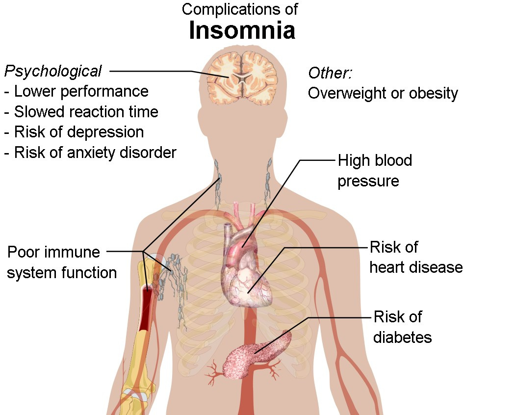 insomnia