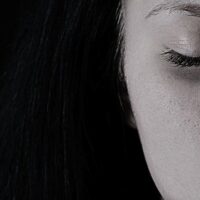 IPL Treatment: Cost, Procedure, and More