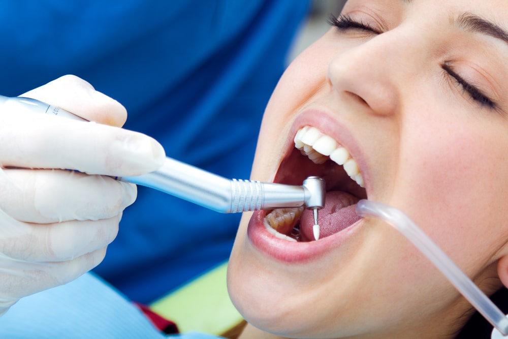 Tooth Fillings Explained: Types, Procedure, Lifespan, Costs and Aftercare for Optimal Dental Health
