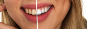 Best Whitening Toothpastes to a Bright dazzling smile - How to Whiten Your Teeth