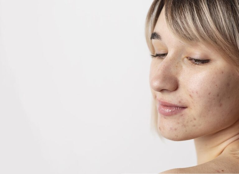 Comprehensive Guide: 25+ Causes of Raised Skin Bumps – Symptoms, Pictures, and When to See a Doctor (2026 Update)