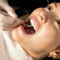 Best Teeth Whitening Methods in 2025: Safe, Effective Guide to Professional and At-Home Bleaching 3 Best Teeth Whitening Methods in 2025: Safe, Effective Guide to Professional and At-Home Bleaching