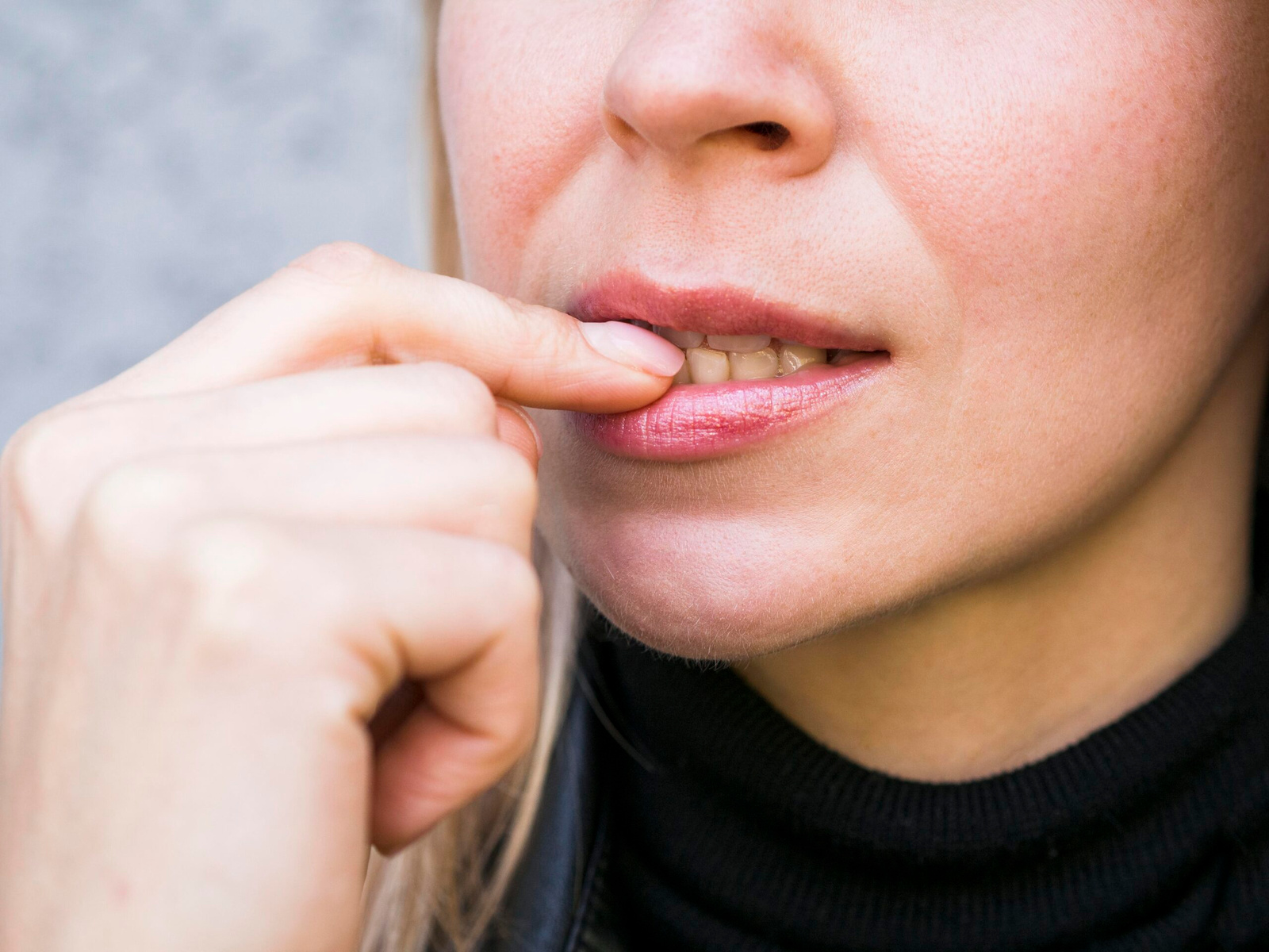 Feature image Canker Sores: Symptoms, Causes, and Treatments