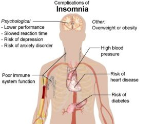 insomnia