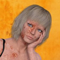 Heat Rash (Prickly Heat): Essential Causes, Symptoms, and Proven Treatment Guide for Quick Relief 4 Heat Rash (Prickly Heat): Essential Causes, Symptoms, and Proven Treatment Guide for Quick Relief