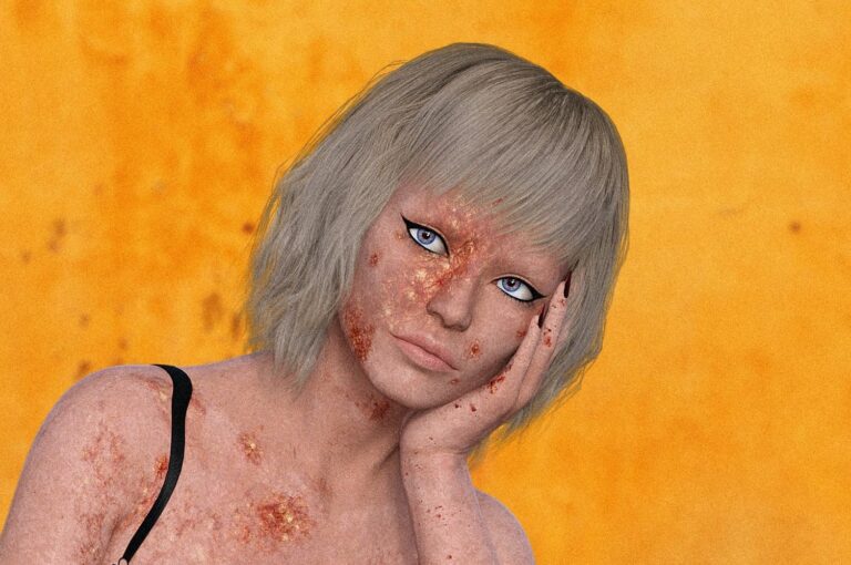 Heat Rash (Prickly Heat): Essential Causes, Symptoms, and Proven Treatment Guide for Quick Relief