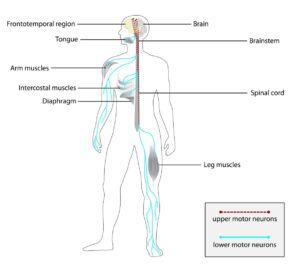 Amyotrophic Lateral Sclerosis (ALS): Symptoms and Causes Explained
