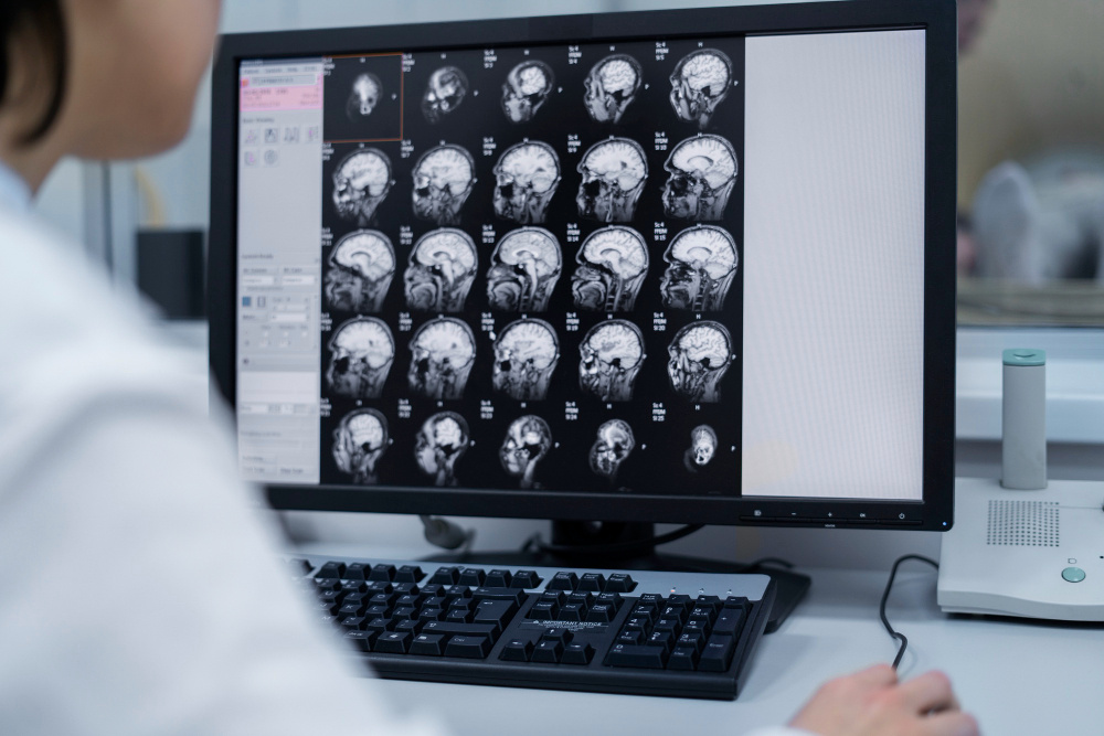 Feature image Brain Tumor - Symptoms and Causes Explained